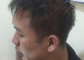 Nekat! Pencuri Motor Tusuk Warga Saat Tertangkap Basah!